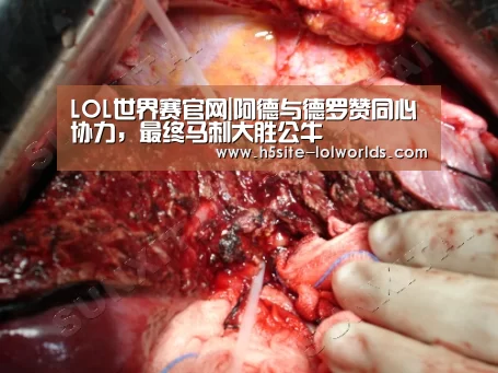 LOL世界赛官网|阿德与德罗赞同心协力,最终马刺大胜公牛(图4) 全球总决赛官网